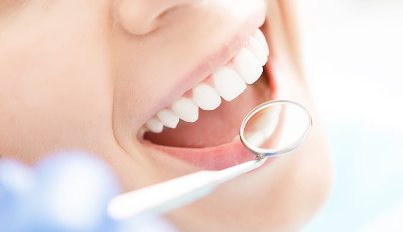 Implantatgestützter Zahnersatz